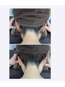 ミース 仙台長町店/うなじ●ビフォーアフター