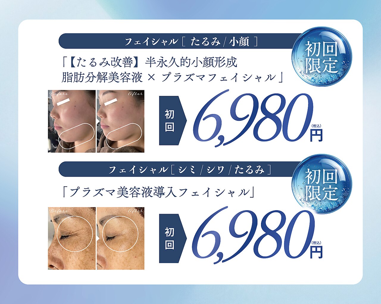 値下げしました！エステサロン　EMS 新潟県でEMSが人気のエステサロン｜ホットペッパービューティー