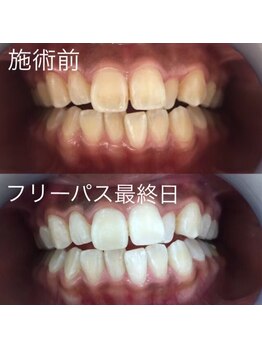 ルブラン 奈良店(Le Blanc)/健康な歯で健康な身体を。