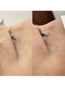 リンダ(LINDA)/パーソナルまつ毛パーマ