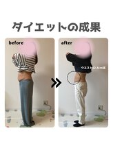 ファミール鍼灸整体院(famille鍼灸整体院)/体重マイナス13kg