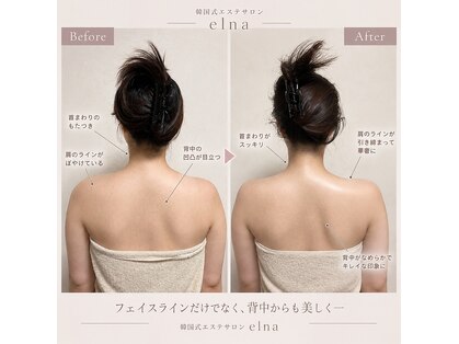 エルナ(Elna)の写真