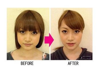 エミット(emit.)/美顔矯正　ビフォーアフター