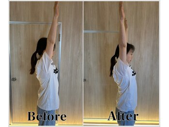 整体ラルース 中目黒(LALUZ)/40代 女性 肩こり、巻き肩改善