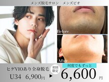メンズビオ 神戸三宮店の雰囲気（全身脱毛1回6,600円～都度払いで何度でも自分のペースで通える♪）