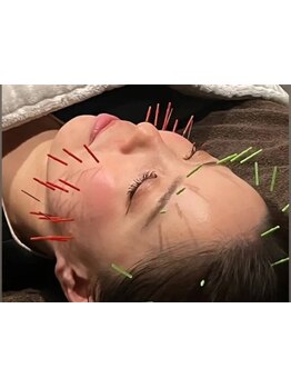 鍼灸施術を受けたい