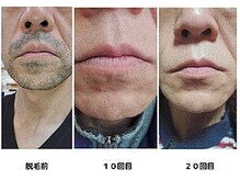 シンバ 南草津店(SIMBA)/☆ ビフォーアフター ☆