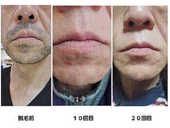 シンバ 南草津店(SIMBA)/☆ ビフォーアフター ☆