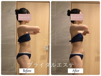 リノ(Lino)/ブライダルエステ♪