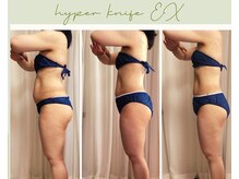 リヘッド(Re.head)