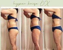 リヘッド(Re.head)