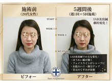 井原鍼灸整骨院/IAB美容鍼