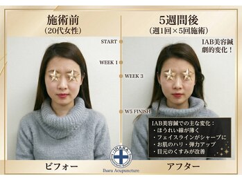 井原鍼灸整骨院/IAB美容鍼