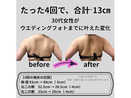 蓮子の夢の写真