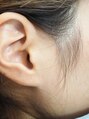 ディオーネ 心斎橋店プレミアム(Dione Premium) 【もみあげ脱毛】気にされている方が多いもみあげ脱毛のみも可能
