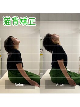 ナオル整体 池袋院(NAORU整体)/猫背施術前後【池袋 整体】