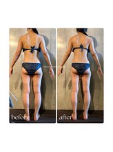 ボーレーヴ 表参道店(beaureve)/施術効果写真（before after）