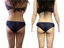 エードット(A.)/before/after