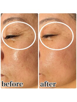 楚々(SOSO)/1回目！