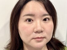 トミー(Tommy)/まつげパーマ