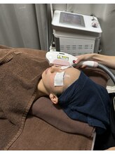 フジグラン安芸ベルミーランド/顔脱毛（ラベンダーパック付）☆