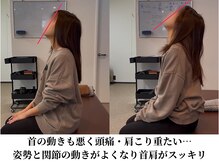みつばち鍼灸整骨院の雰囲気（首の動きもスムーズに!頭痛・肩こり・吐き気が改善♪）