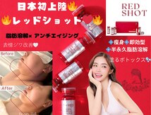 マーキュリー(Mercury)