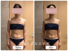 リノ(Lino)/ブライダルエステ♪