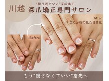リネイル 川越(Re:NAIL)