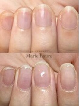 マリーロール 梅田店(Marie Laure)/自爪育成/深爪矯正/ネイルケア