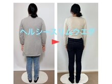 ヘルシースリムウエダ/減量成功【ひばりが丘/痩身/耳】