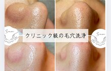 エヌ ドット ジュウイチ(N.11)