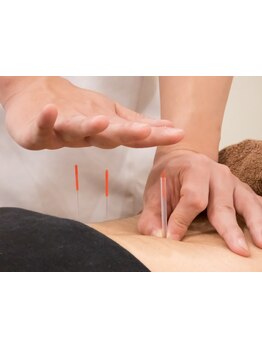 鍼灸施術を受けたい