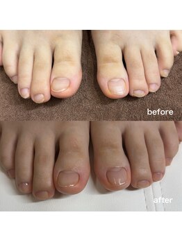 リリ(lili)/フットネイルスキンケア1回目