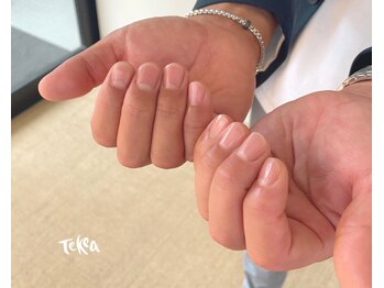 テケア(TEKEA)/メンズケア