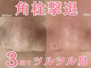 エステティックサロン ベルエトワール住吉店