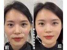 楽だの雰囲気（★施術開始数分で効果が出始めるビフォーアフターが分かリ絶技↑）