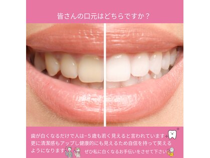 ラポ(Lapo)の写真