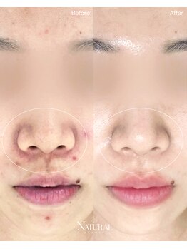 ユーエステティック(U AESTHETIC)/