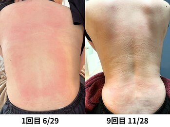 メイヴィ 四日市(Maivi)/20代女性の変化