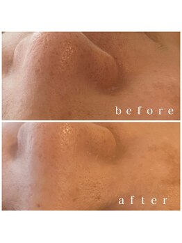 メナードフェイシャルサロン 岐阜茜部/透明感/紫外線ケア/うるおい保湿