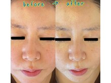 クレール(Claire)/若々しいお肌へ/引上げ/小顔