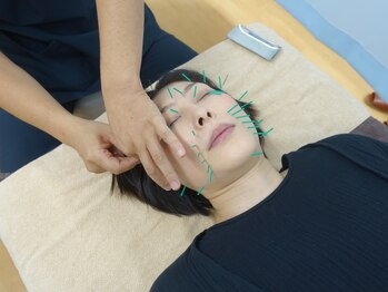 ケイ鍼灸院 in ヒガムコ(kei鍼灸院)/