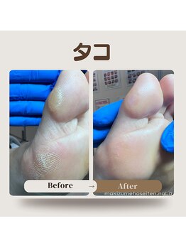 巻き爪補正店 那覇店/