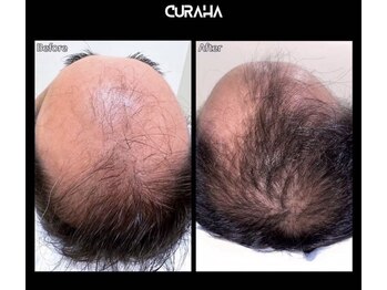 ブルー(blue)/髪質頭皮改善ヘッドスパ