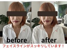 リフー(Re:fuu)/ビフォーアフター