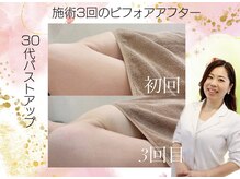 アネラ(ANERA) 心斎橋/30代産後ママバストアップ成功♪