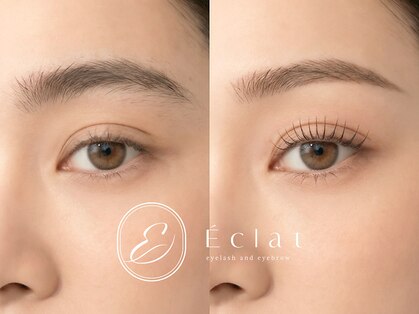 エクラ(Eclat)の写真