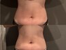 便通改善&ぽっこりお腹改善◎1回でお腹スッキリ実感40分7200円