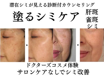 テセラ(Tethere)の写真